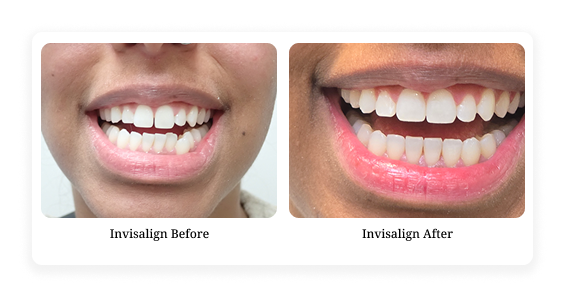 Before & After2